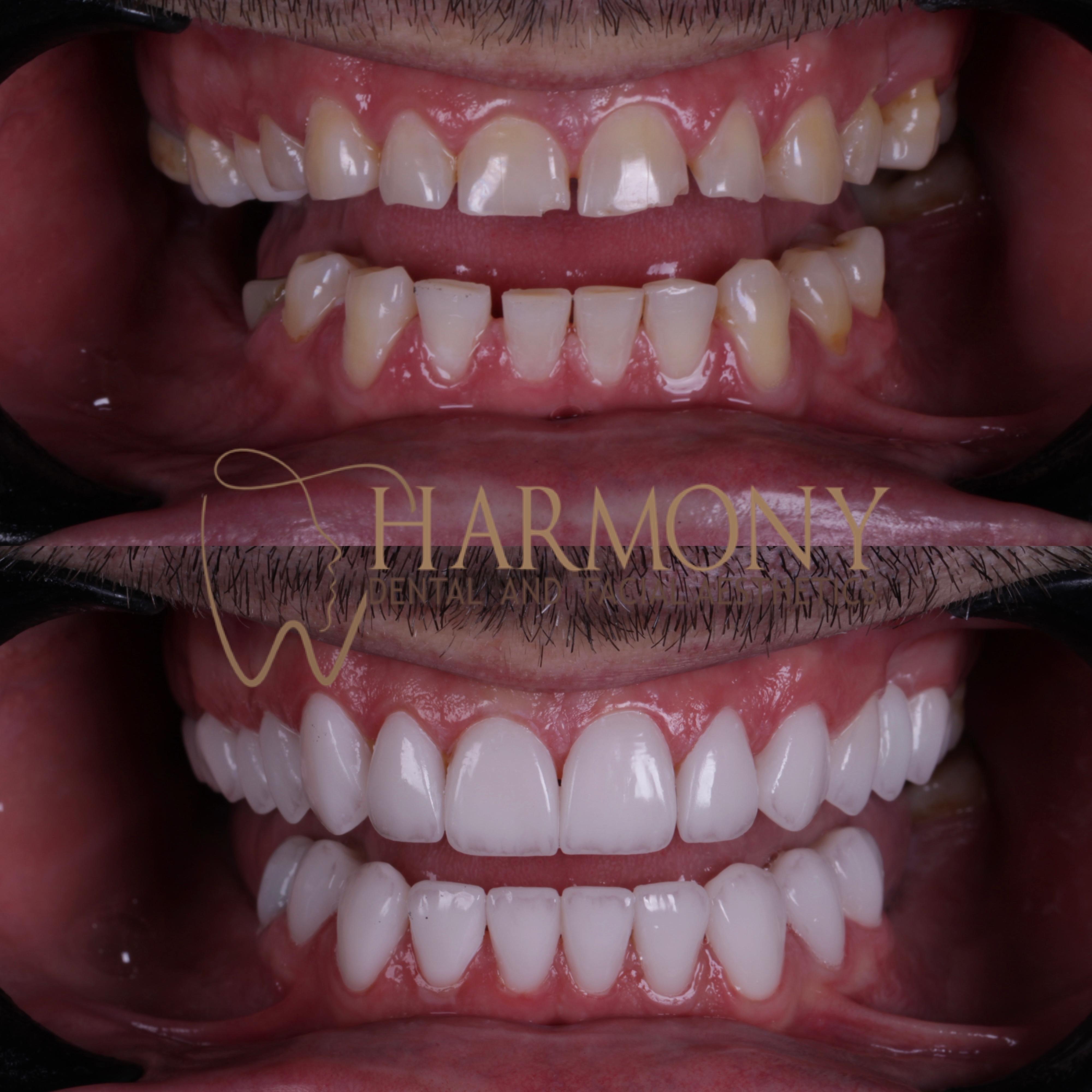 Harmony Tampa