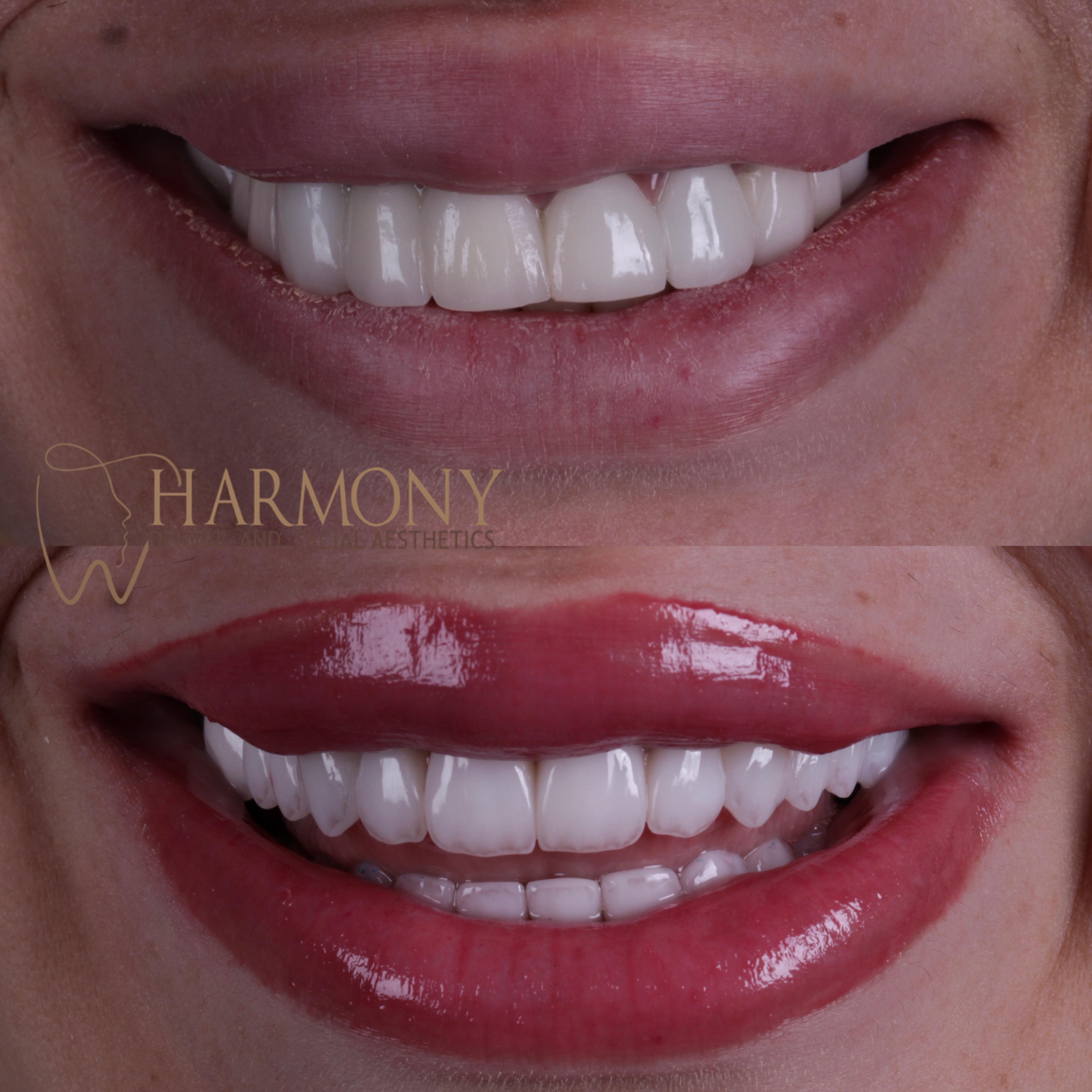 Harmony Tampa