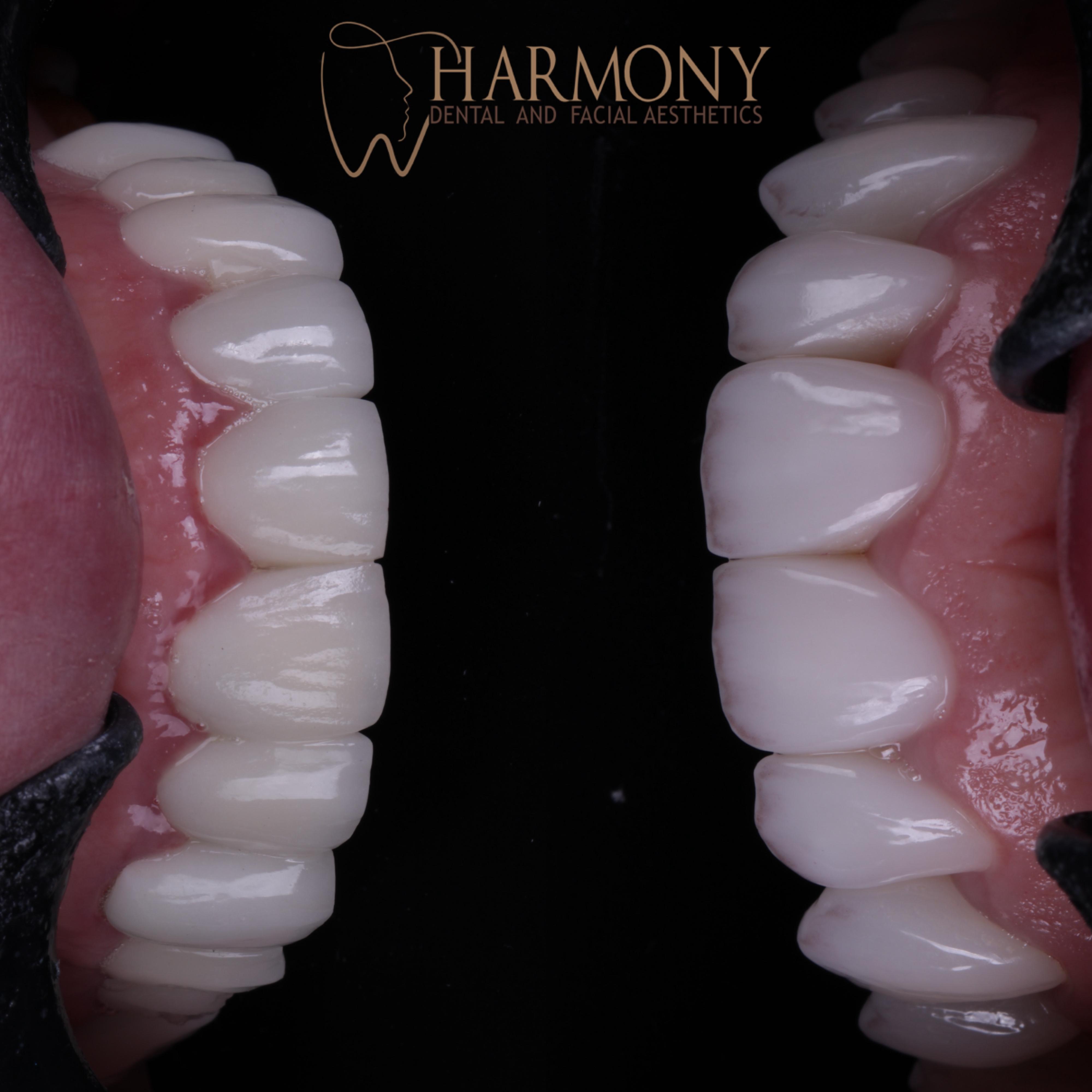 Harmony Tampa