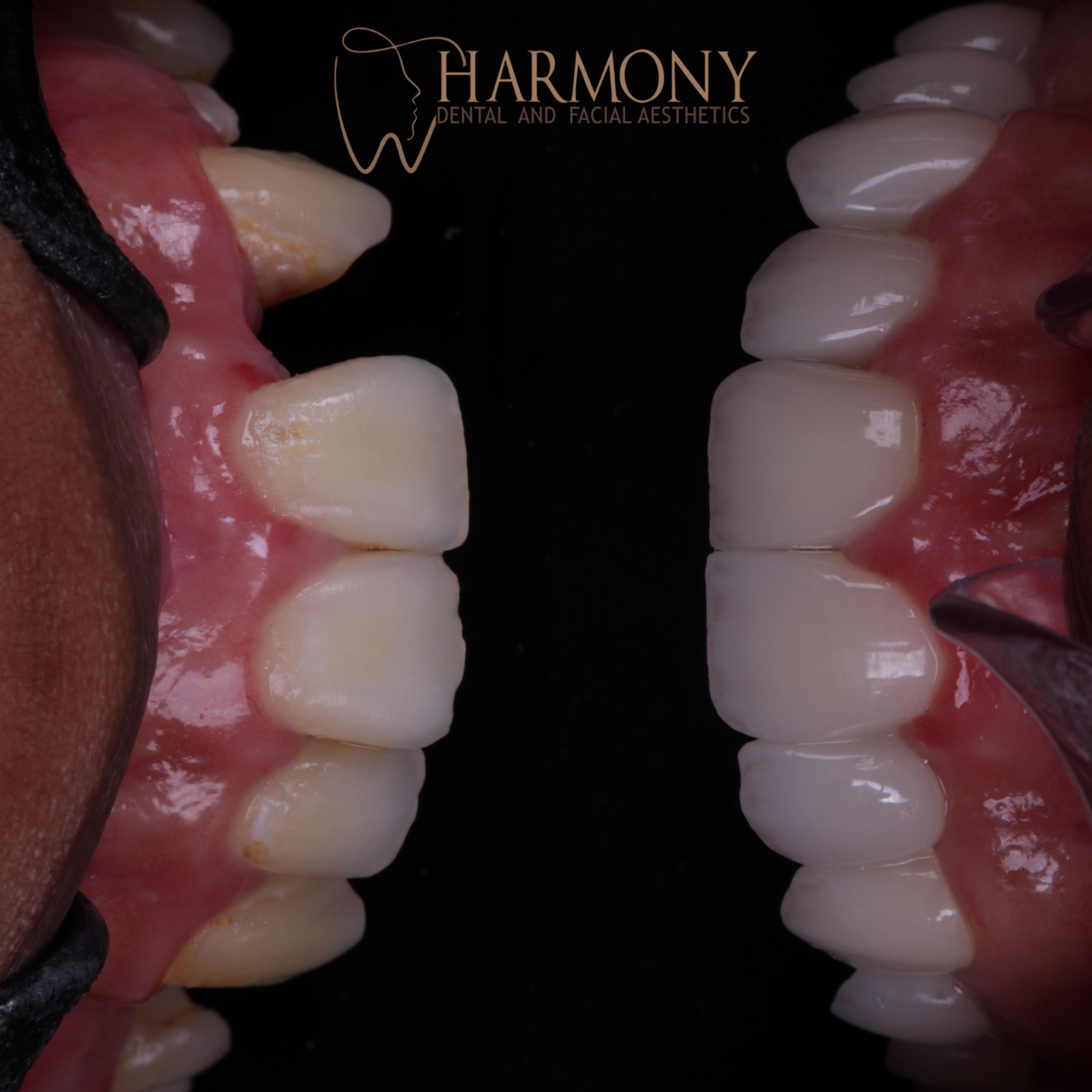 Harmony Tampa