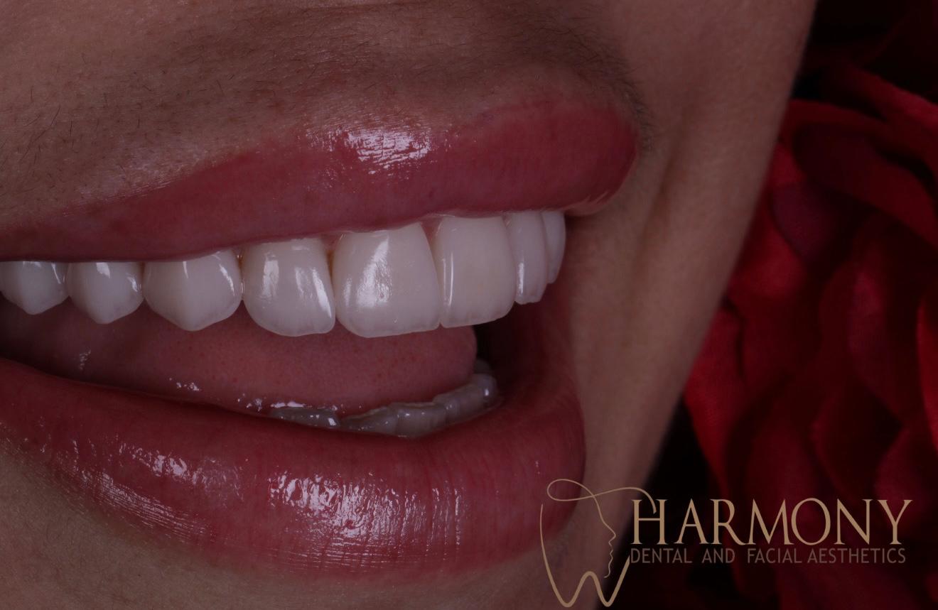 Harmony Tampa