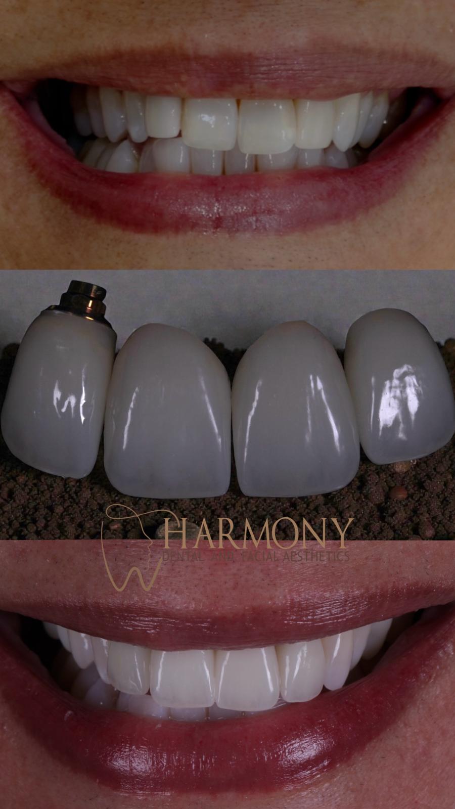 Harmony Tampa