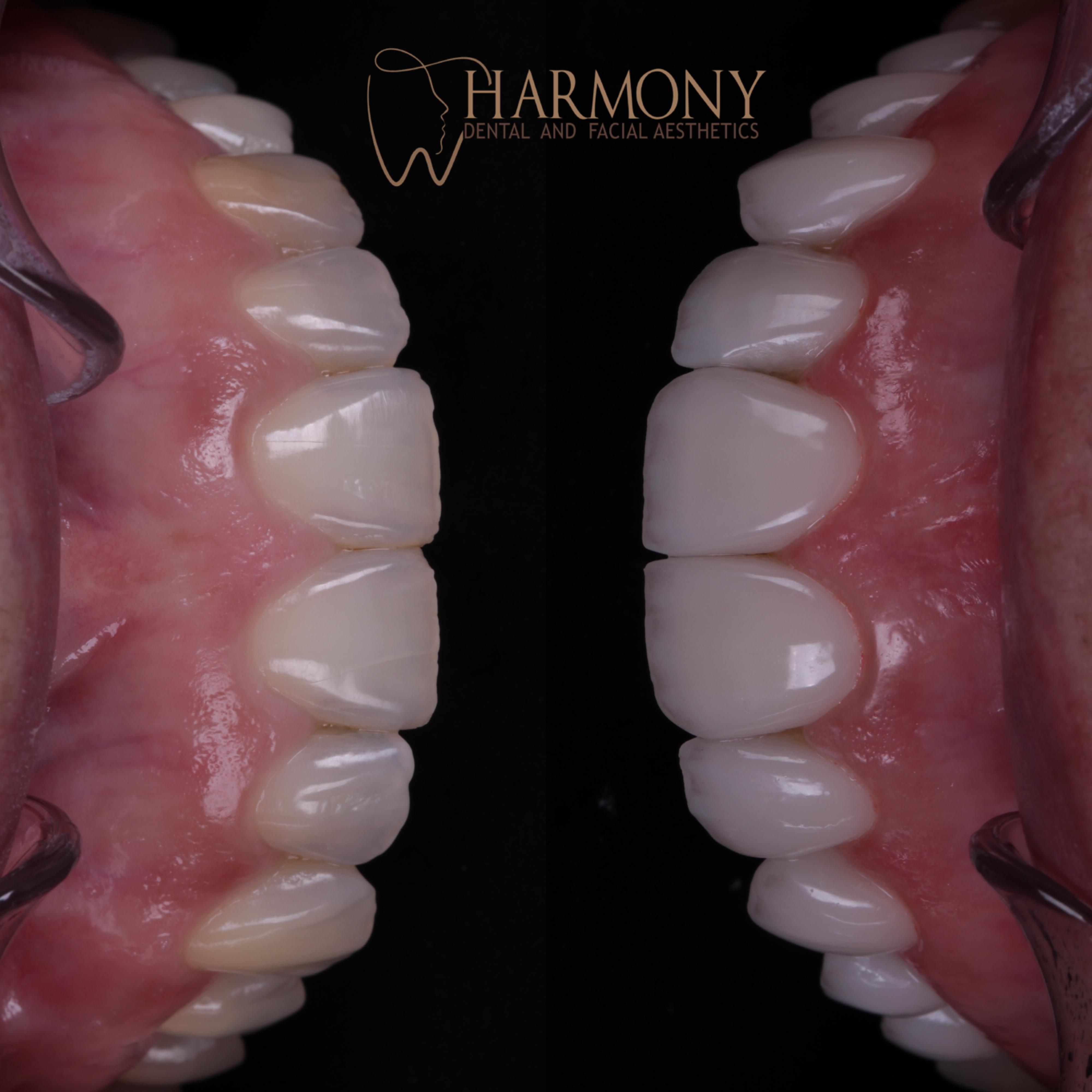 Harmony Tampa