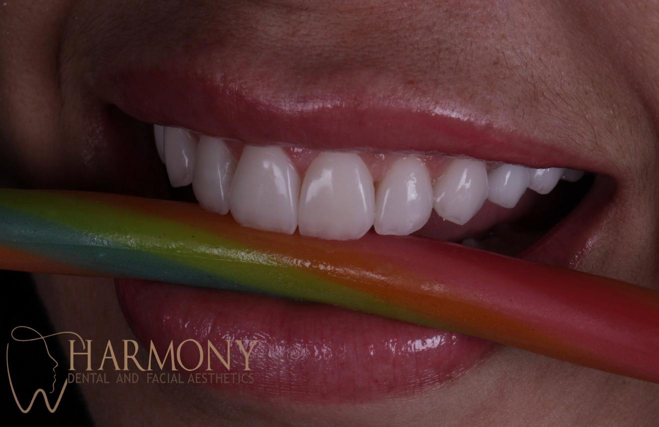 Harmony Tampa