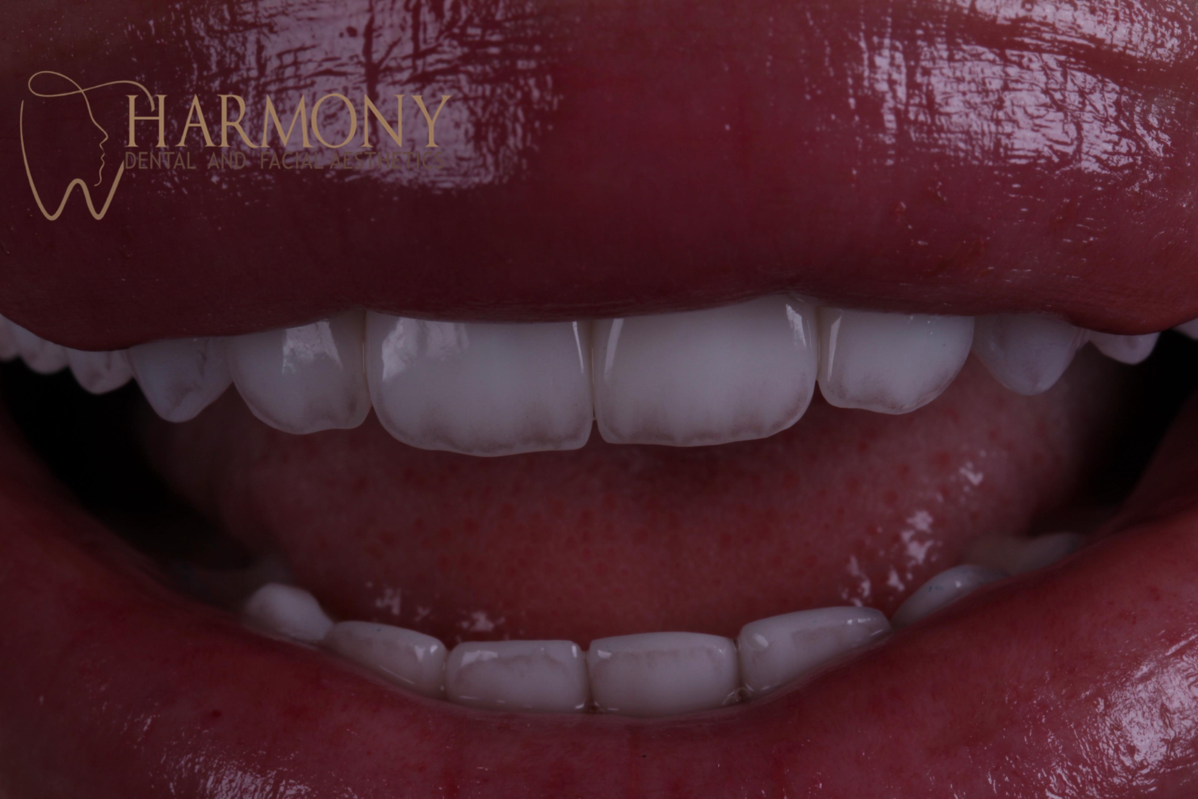Harmony Tampa